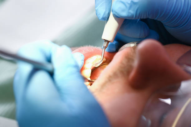 Best Broken or Chipped Tooth Repair in Trinity, TX