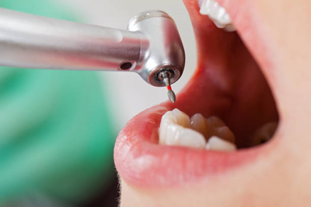 Best Broken or Chipped Tooth Repair in Trinity, TX